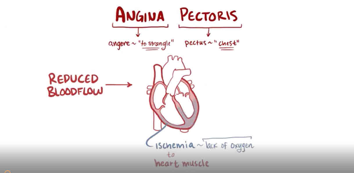 AWT IMAGE